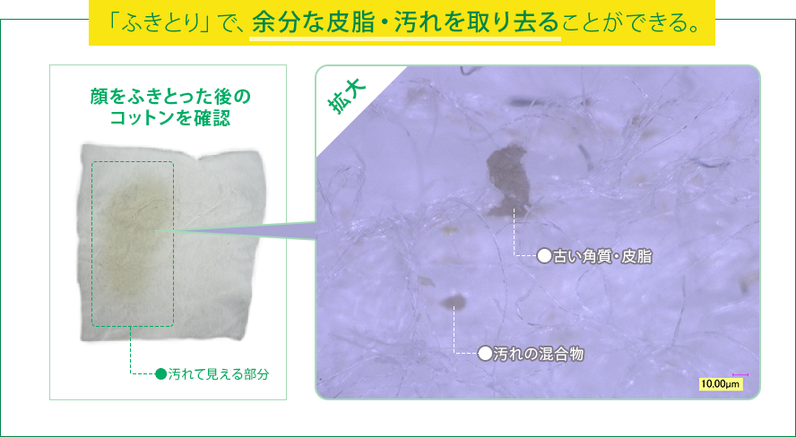 「ふきとり」で、余分な皮脂・汚れを取り去ることができる。