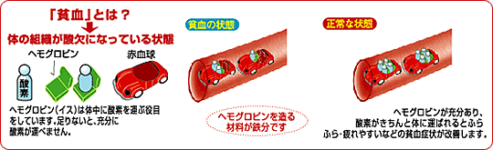 貧血とは?