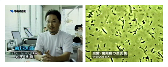 CMの変遷その2…特徴となった6本入りの誕生