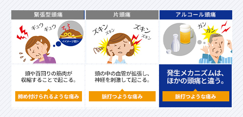 緊張型頭痛 頭や首回りの筋肉が収縮することで起こる。締め付けられるような痛み  片頭痛 頭の中の血管が拡張し、神経を刺激して起こる。  アルコール頭痛 発生メカニズムは、ほかの頭痛と違う。 脈打つような痛み