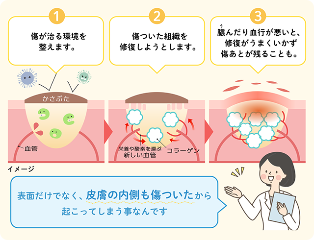 傷の修復過程のイメージ図
