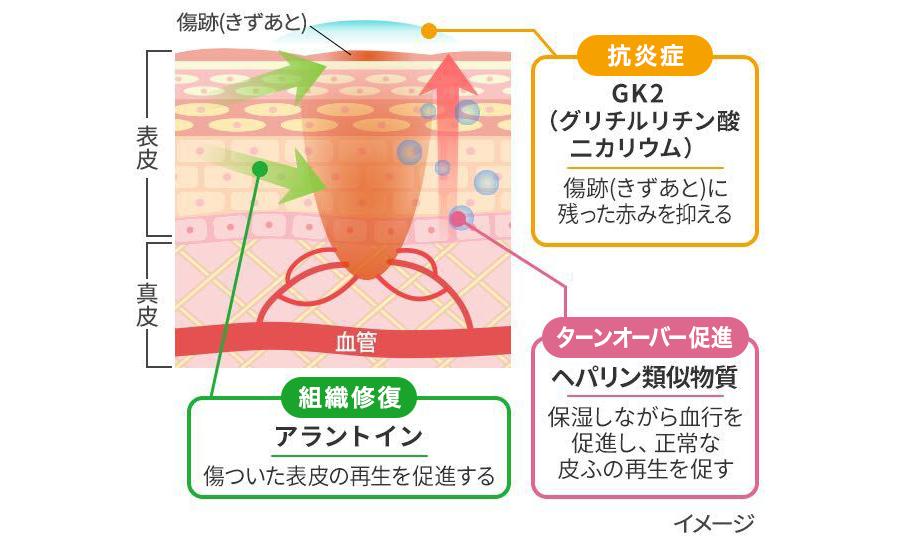 傷跡(きずあと)ケアの有効成分