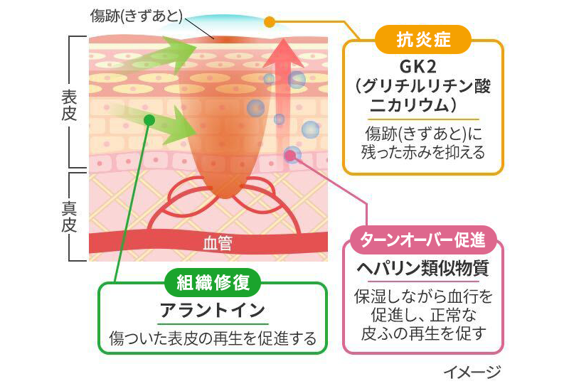 傷跡(きずあと)ケアの有効成分