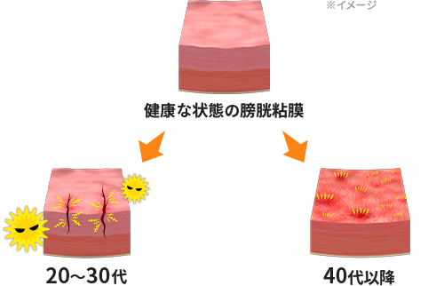 年代別の症状・メカニズム