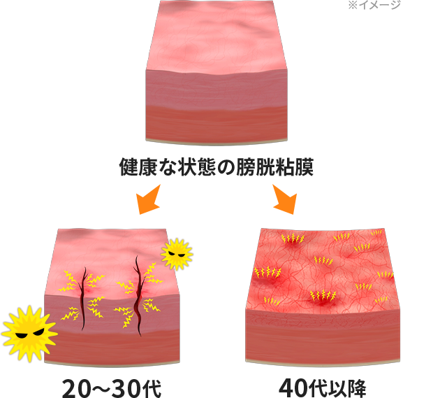 年代別の症状・メカニズム