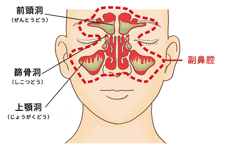 副鼻腔炎症候群の診断