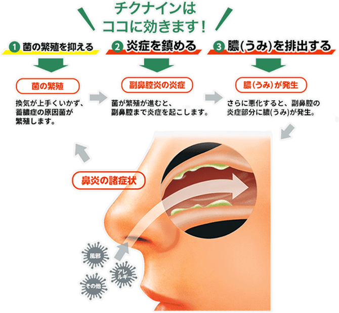 チクナインはここに効きます！ ①菌の繁殖を抑える → 菌の繁殖 換気がうまくいかず、蓄膿症の原因菌が繁殖します。→ ②炎症を鎮める→副鼻腔炎の炎症 菌の繁殖が進むと、副鼻腔まで炎症を起こします。→ ③膿（うみ）を排出する→膿（うみ）が発生 さらに悪化すると、副鼻腔の炎症部分に膿（うみ）が発生。→ 鼻炎の諸症状
