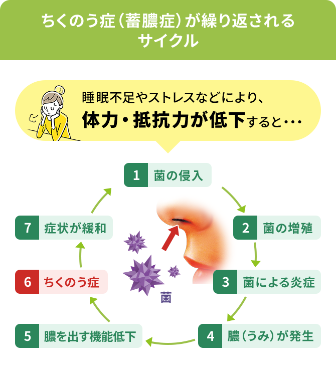 ちくのう症（蓄膿症）が繰り返されるサイクル
                