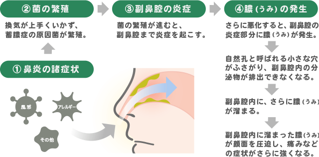 ちくのう症(副鼻腔炎)のイメージ図