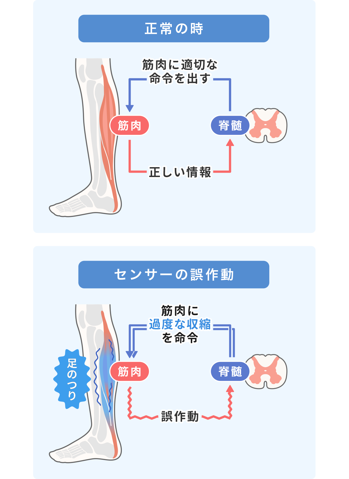 足がつる（こむら返り）原因のイメージ