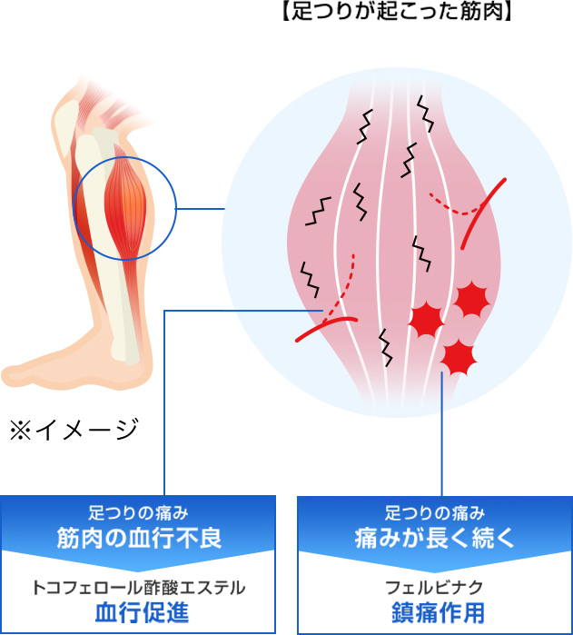 コムレケアヨコヨコは血行促進と鎮痛作用成分で筋肉の痛みを鎮めます