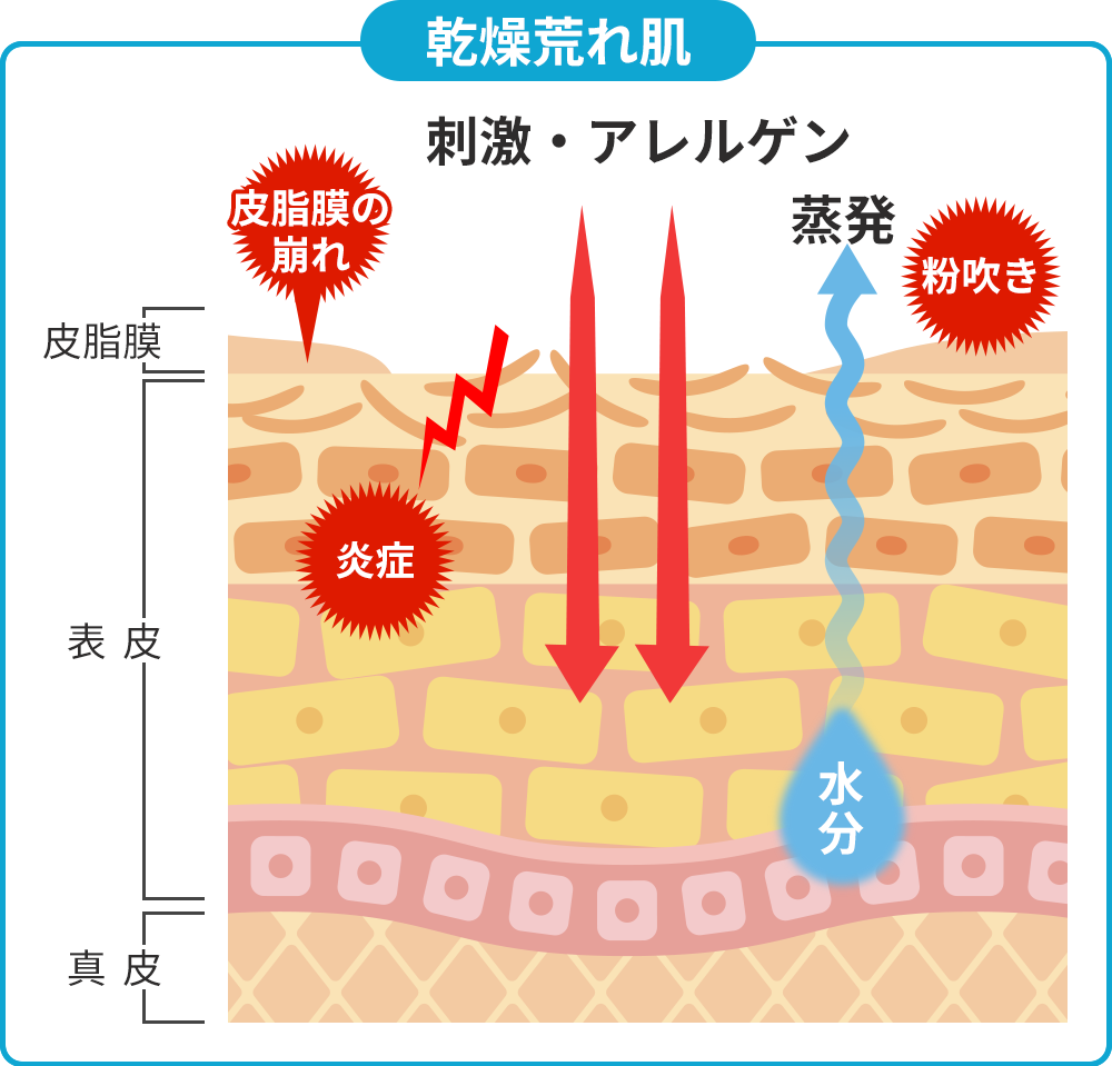 乾燥荒れ肌