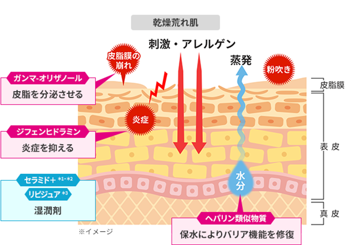図：乾燥荒れ肌