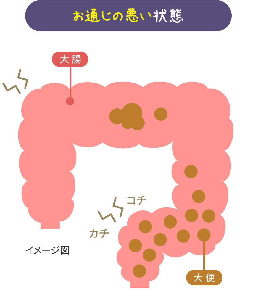 お通じの悪い状態