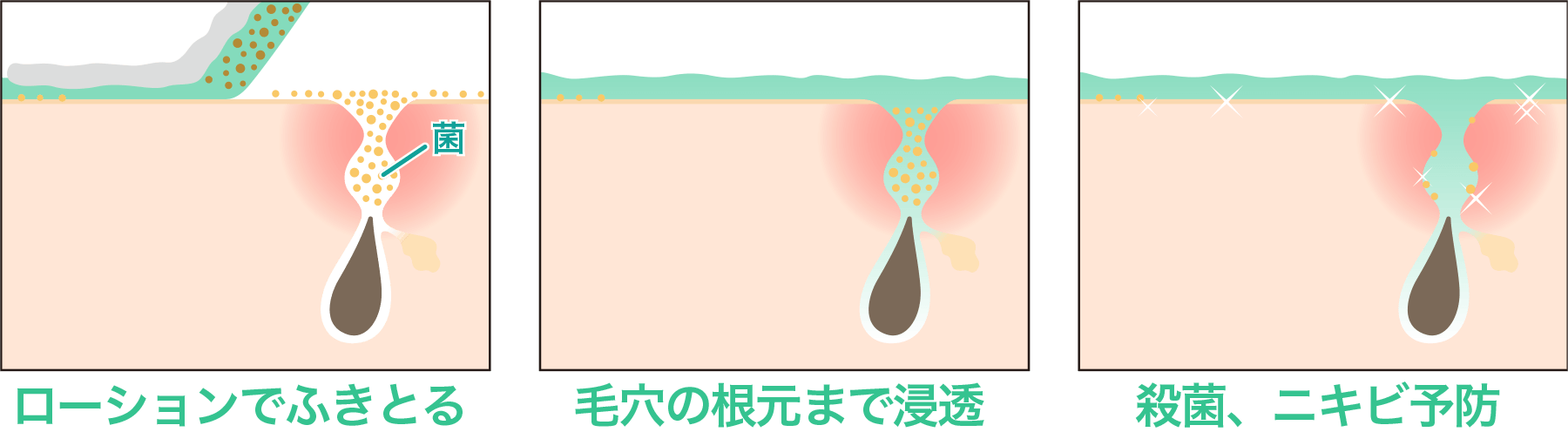 ���[�V�����łӂ��Ƃ� �ь��̍����܂ŐZ�� �E�ہA�j�L�r�\�h