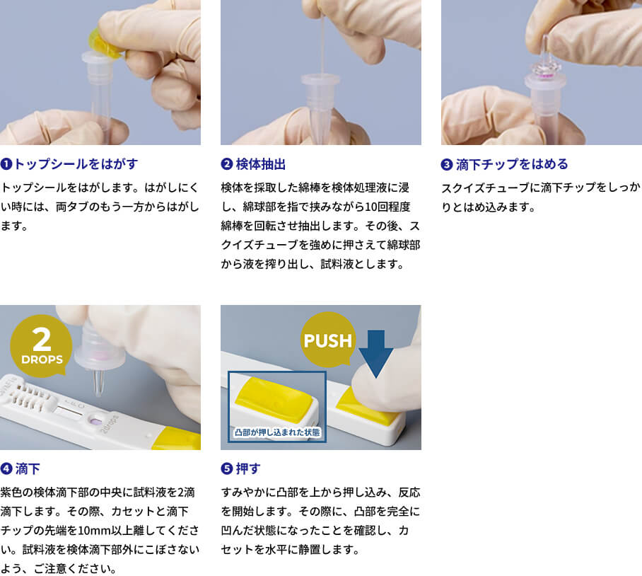 1:トップシールをはがす トップシールをはがします。はがしにくい時には、両タブのもう一方からはがします。2:検体を採取した綿棒を検体処理液に浸し、綿球部を指で挟みながら10回程度綿棒を回転させ抽出します。その後、スクイズチューブを強めに押さえて綿球部から液を搾り出し、試料液とします。3:滴下チップをはめる スクイズチューブに滴下チップをしっかりとはめ込みます。4:滴下 紫色の検体滴下部の中央に試料液を2滴滴下します。その際、カセットと滴下チップの先端を10mm以上離してください。試料液を検体滴下部外にこぼさないよう、ご注意ください。5:押す すみやかに凸部を上から押し込み、反応を開始します。その際に、凸部を完全に凹んだ状態になったことを確認し、カセットを水平に静置します。