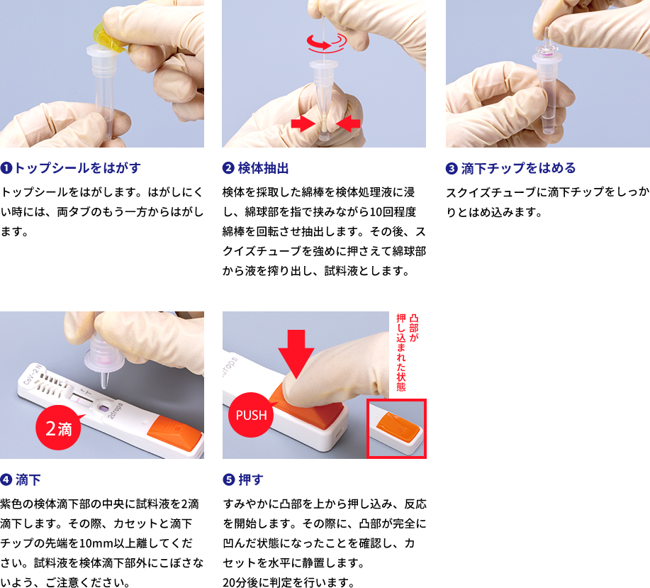 1:トップシールをはがす トップシールをはがします。はがしにくい時には、両タブのもう一方からはがします。2:検体抽出 検体を採取した綿棒を検体処理液に浸し、綿球部を指で挟みながら10回程度綿棒を回転させ抽出します。その後、スクイズチューブを強めに押さえて綿球部から液を搾り出し、試料液とします。3:滴下チップをはめる スクイズチューブに滴下チップをしっかりとはめ込みます。4:滴下 紫色の検体滴下部の中央に試料液を2滴滴下します。その際、カセットと滴下チップの先端を10mm以上離してください。試料液を検体滴下部外にこぼさないよう、ご注意ください。5:押す すみやかに凸部を上から押し込み、反応を開始します。その際に、凸部が完全に凹んだ状態になったことを確認し、カセットを水平に静置します。20分後に判定を行います。