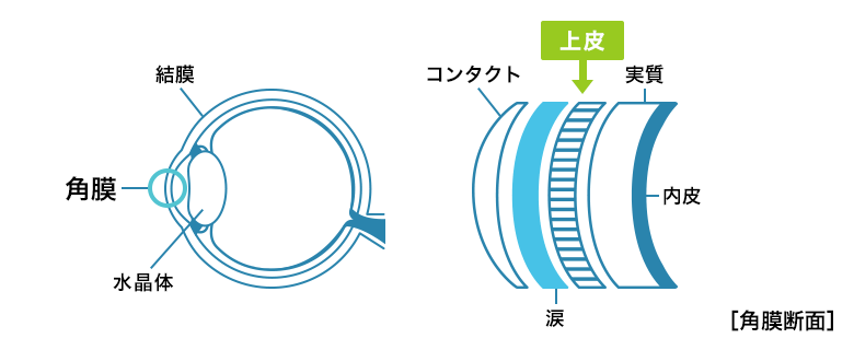 角膜断面図