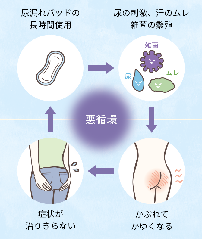 悪循環 尿の刺激、 汗ムレ 細菌の繁殖 かぶれて かゆい 症状が 治りきらない 尿パット