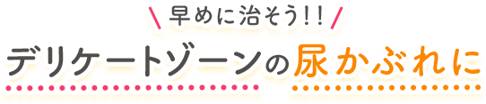 早めに治そう！！デリケートゾーンのかゆみ、かぶれ