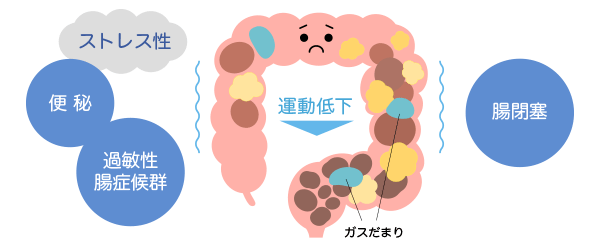 腸内ガスの排出低下