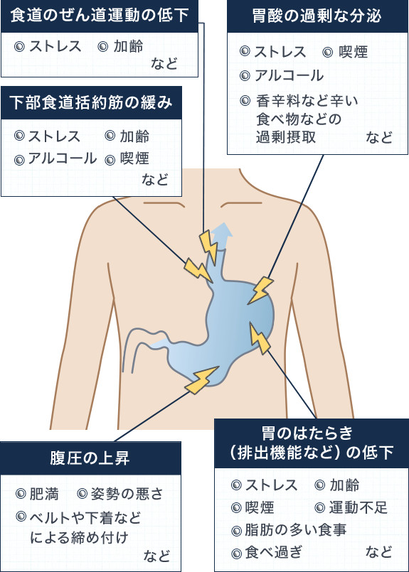 [�H���̂��񓹉^���̒ቺ]�F�X�g���X�A����Ȃǁ@[�����H������؂̊ɂ�]�F�X�g���X�A����A�A���R�[���A�i���Ȃǁ@[�����̏㏸]�F�얞�A�x���g�≺���Ȃǂɂ����ߕt���A�p���̈����Ȃǁ@[�ݎ_�̉ߏ�ȕ���]�F�X�g���X�A���h���Ȃǐh���H�ו��Ȃǂ̉ߏ�ێ�A�i���A�A���R�[���@[�݂̂͂��炫�i�r�o�@�\�Ȃǁj�̒ቺ]�F�X�g���X�A����A�i���A�^���s���A���b�̑��������A�H�׉߂�