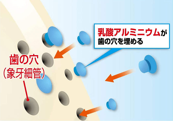 歯の穴を埋めてしみるのを防ぐ ハウメル 小林製薬