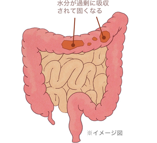 �������ߏ�ɋz������Čł��Ȃ遦�C���[�W�}