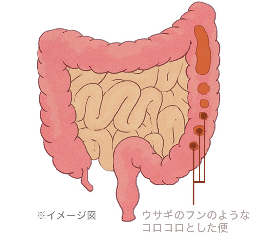 �E�T�M�̃t���̂悤�ȃR���R���Ƃ����ց��C���[�W�}