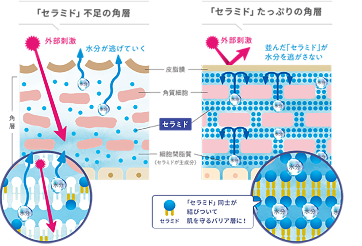 セラミドの不足は「敏感肌」につながる