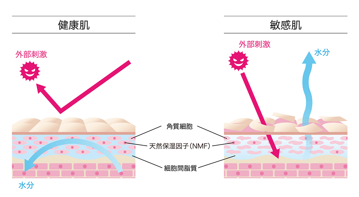 どうして敏感肌になるの？