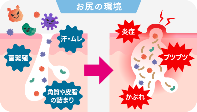 お尻の環境