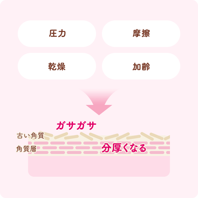 かかとには古い角質がたまりがち イメージイラスト