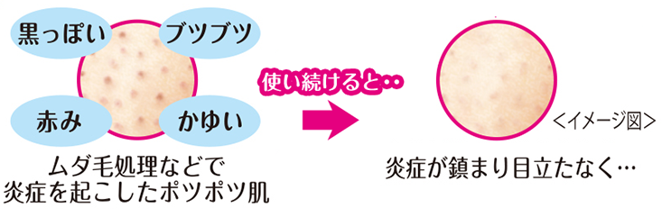 ムダ毛処理などで炎症を起こしたボツボツ肌、使い続けると炎症が鎮まり目立たなく