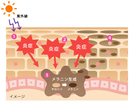 紫外線とシミ