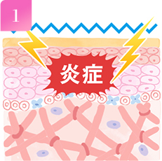 1 CȂǂ̎hɂAŉǂN