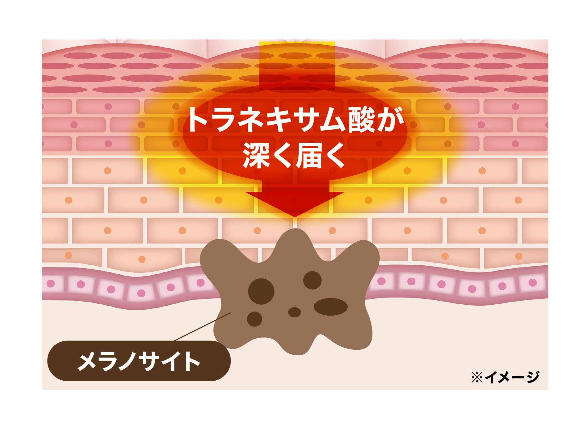 イメージ画像