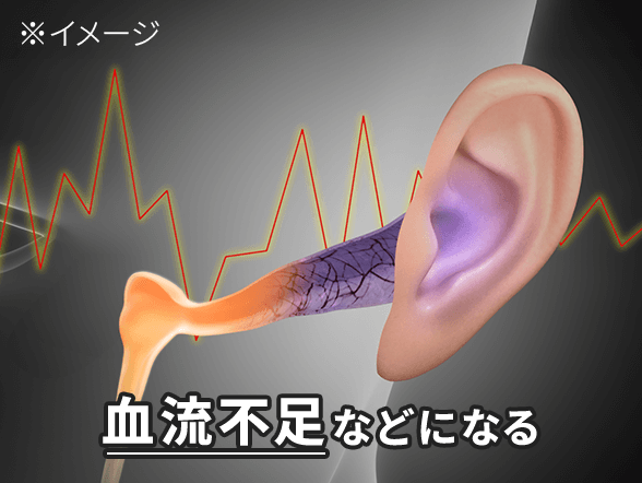血流不足などになる※イメージ