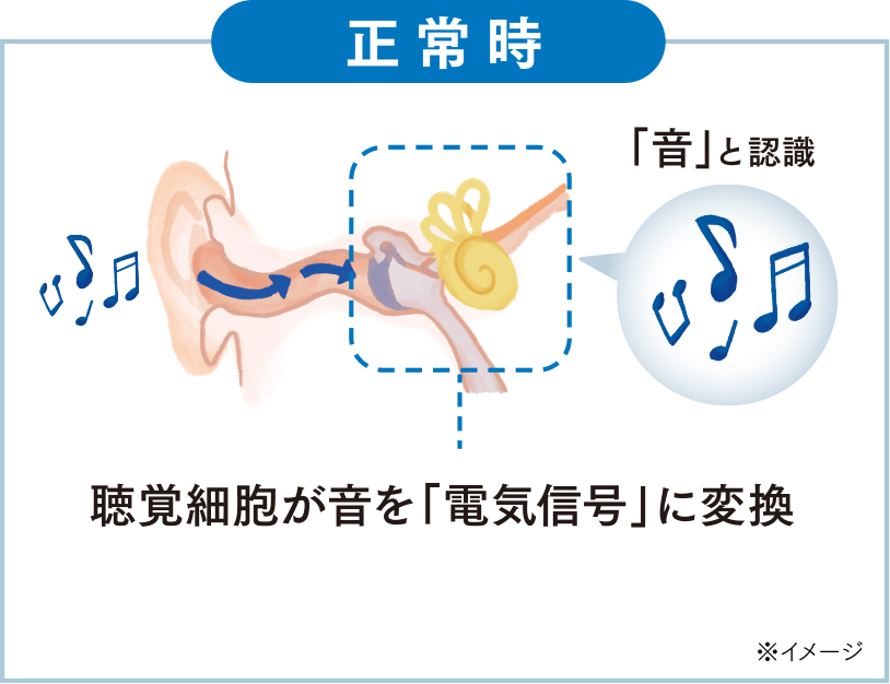 【正常時】聴覚細胞が音を「電気信号」に変換※イメージ