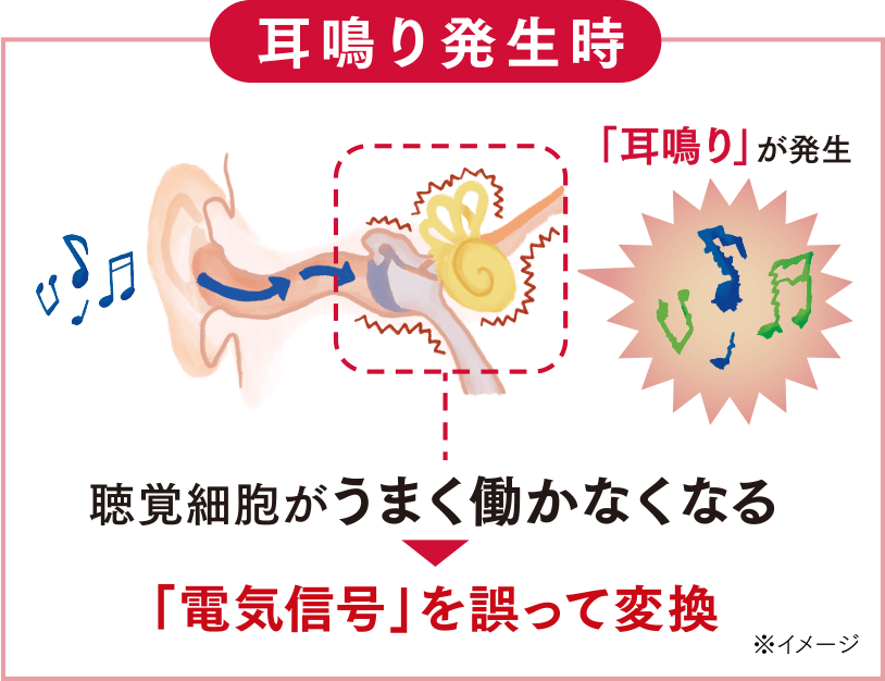 【耳鳴り発生時】聴覚細胞がうまく働かなくなり、「電気信号」を誤って変換※イメージ