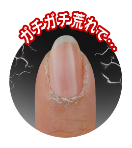 ガチガチ荒れの指先