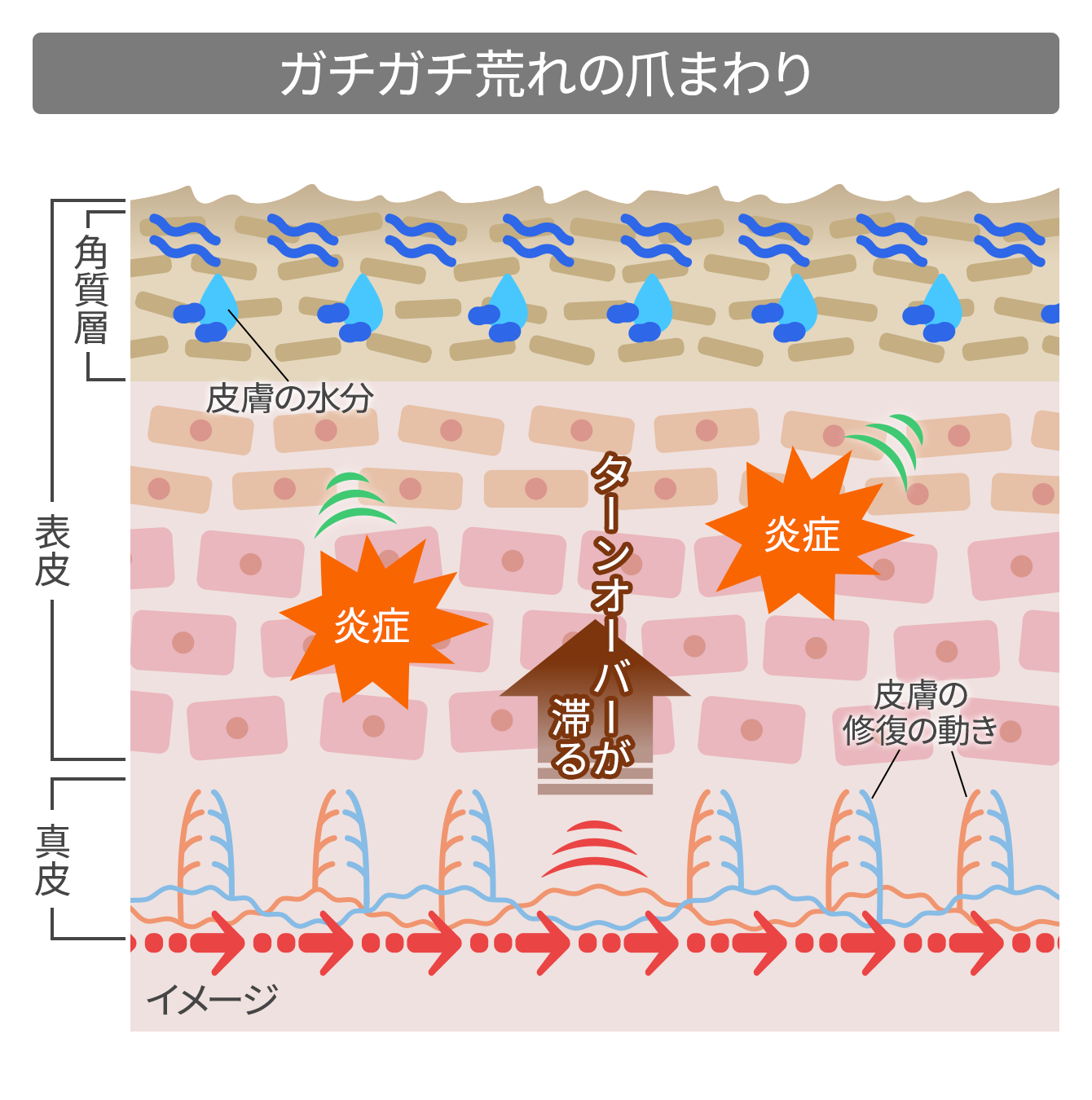 ガチガチ荒れの爪まわりの皮膚 簡略図