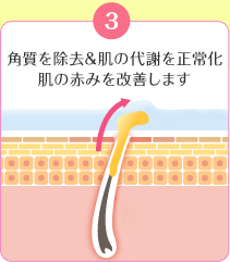 Rp̑ӂ𐳏퉻̐Ԃ݂P܂