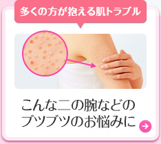 ȓ̘rȂǂ̃ucuĉY݂