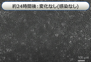 約24時間後：変化なし（感染なし）