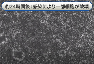 約24時間後：感染により一部細胞が破壊