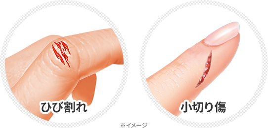 ひび割れ 小切り傷 ※イメージ