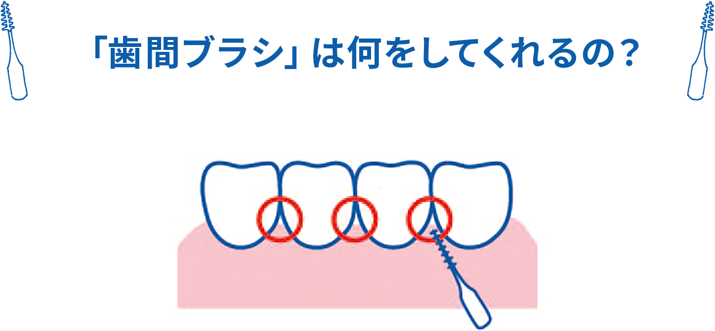 「歯間ブラシ」は何をしてくれるの？