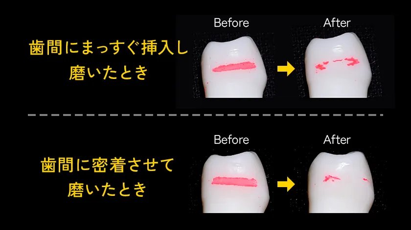 歯間ブラシを使用した磨き方の違いを示す比較画像。上段は垂直に往復して磨いた場合、下段は歯間に密着させて磨いた場合の結果