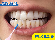持ち手付きフロス（I字型）の挿入方法